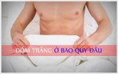 
						Đốm Trắng Ở Bao Quy Đầu Là Triệu Chứng Của Bệnh Gì?