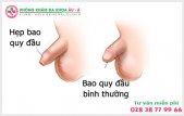 
						Làm Thế Nào Để Nhận Biết Dấu Hiệu Hẹp Bao Quy Đầu?