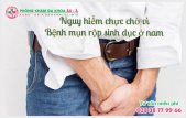 
						Mụn Rộp Sinh Dục – Nguyên nhân và phương pháp hỗ trợ điều trị