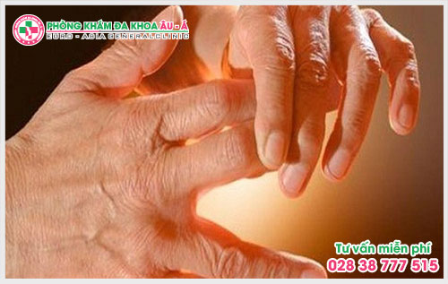 Theo các chuyên gia Da Liễu Âu Á bệnh ngứa lòng bàn tay bàn chân có thể là dấu hiệu của một bệnh lý nào đó.